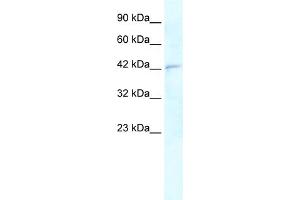 WB Suggested Anti-RNF2 Antibody Titration:  0. (RNF2 anticorps  (Middle Region))