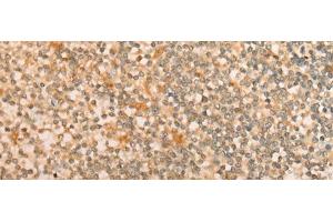Immunohistochemistry of paraffin-embedded Human tonsil tissue using CFHR2 Polyclonal Antibody at dilution of 1:35(x200)