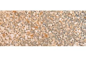 Immunohistochemistry of paraffin-embedded Human tonsil tissue using CFHR2 Polyclonal Antibody at dilution of 1:35(x200) (CFHR2 anticorps)