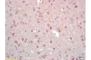 Formalin-fixed and paraffin embedded rat brain labeled with Rabbit Anti ZNF300 Polyclonal Antibody, Unconjugated (ABIN671091) at 1:200 followed by conjugation to the secondary antibody and DAB staining (ZNF300 anticorps  (AA 165-250))