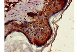 Immunohistochemistry of paraffin-embedded human skin tissue using ABIN7143911 at dilution of 1:100