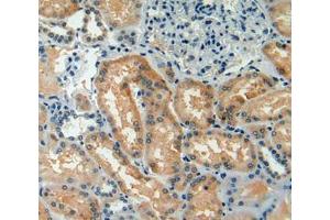 Used in DAB staining on fromalin fixed paraffin- embedded kidney tissue