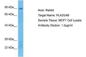 Host: Rabbit Target Name: PLA2G4B Sample Type: MCF7 Whole Cell lysates Antibody Dilution: 1. (PLA2G4B anticorps  (C-Term))
