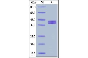 Human C5a, Fc Tag on  under reducing (R) condition. (C5A Protein (AA 679-751) (Fc Tag))