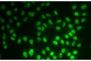 Immunofluorescence analysis of MCF-7 cells using SNRPD1 Polyclonal Antibody (SNRPD1 anticorps)
