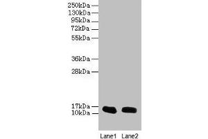 Western blot All lanes: FABP1 antibody at 16 μg/mL Lane 1: Mouse liver tissue Lane 2: Mouse small intestine tissue Secondary Goat polyclonal to rabbit IgG at 1/10000 dilution Predicted band size: 15 kDa Observed band size: 15 kDa (FABP1 anticorps  (AA 1-127))