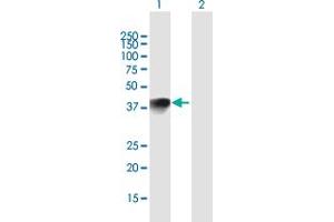 Western Blot analysis of HMX1 expression in transfected 293T cell line by HMX1 MaxPab polyclonal antibody. (HMX1 anticorps  (AA 1-348))
