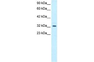 WB Suggested Anti-TAL1 Antibody Titration:  0. (TAL1 anticorps  (C-Term))