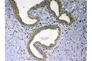 IHC analysis of MAVS using anti-MAVS antibody .