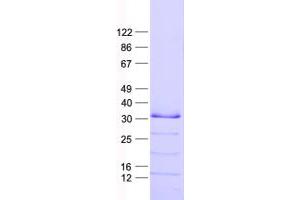 Validation with Western Blot