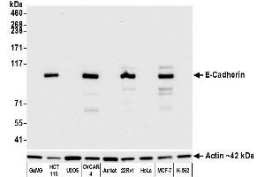 Western Blotting (WB) image for anti-Cadherin 1, Type 1, E-Cadherin (Epithelial) (CDH1) (AA 155-707) antibody (ABIN7455206)