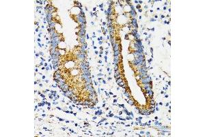 Immunohistochemistry of paraffin-embedded human vermiform appendix using HSPA9 antibody.