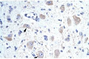 Immunohistochemical staining (Formalin-fixed paraffin-embedded sections) of human brain with KCNIP1 polyclonal antibody . (KCNIP1 anticorps  (N-Term))