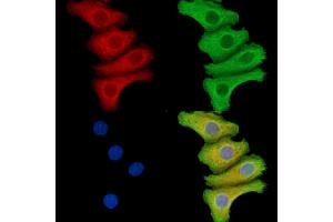 SEPN1 Antibody staining Hela cells by IF/ICC. (SEPN1 anticorps)