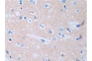DAB staining on IHC-P; Samples: Human Cerebrum Tissue (Protein Phosphatase 3, Regulatory Subunit 1 (AA 2-170) anticorps)