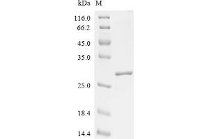 (Tris-Glycine gel) Discontinuous SDS-PAGE (reduced) with 5 % enrichment gel and 15 % separation gel.