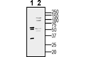 Western blot analysis of human  MG glioblastoma cell line lysate (lane 1) and  MG-derived purified exosomes (lane 2)50 μg of cells and purified exosomes lysates were analyzed using Anti-CD9 (extracellular) Antibody (ABIN7581848), (1:200). (CD9 anticorps  (Extracellular))