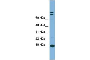 WB Suggested Anti-TFF1 Antibody Titration:  0. (TFF1 anticorps  (Middle Region))