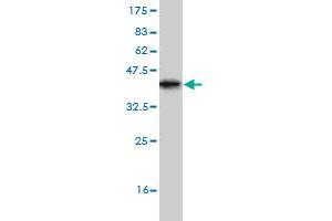 Western Blot detection against Immunogen (36. (TRIP6 anticorps  (AA 51-148))