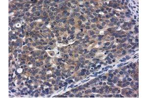 Immunohistochemical staining of paraffin-embedded Human Kidney tissue using anti-CBWD1 mouse monoclonal antibody. (CBWD1 anticorps)