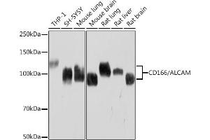 Western blot analysis of extracts of various cell lines, using CD166/ALCAM Rabbit mAb (ABIN7265401) at 1:1000 dilution.