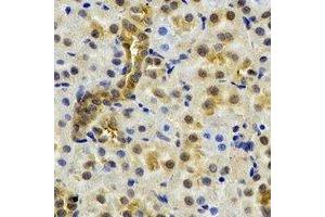 Immunohistochemical analysis of NAT13 staining in rat kidney formalin fixed paraffin embedded tissue section. (NAA50 anticorps)