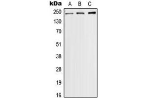 Western blot analysis of Nav1. (SCN9A anticorps  (Center))