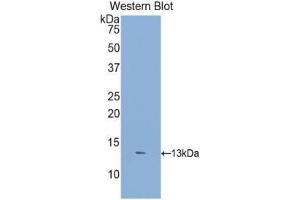 Western Blotting (WB) image for anti-Dickkopf 2 Homolog (DKK2) (AA 159-258) antibody (ABIN3207349) (DKK2 anticorps  (AA 159-258))