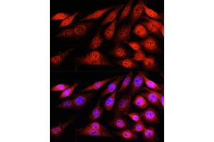 Immunofluorescence analysis of NIH-3T3 cells using VCP Rabbit mAb (ABIN7271284) at dilution of 1:100 (40x lens).