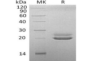 Western Blotting (WB) image for Fibroblast Growth Factor 21 (FGF21) protein (His tag) (ABIN7320969)