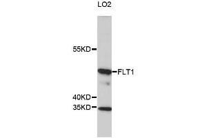 Western blot analysis of extracts of LO2 cells, using FLT1 antibody (ABIN5969988) at 1/1000 dilution. (FLT1 anticorps)