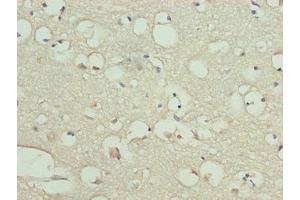 Immunohistochemistry of paraffin-embedded human brain tissue using ABIN7150922 at dilution of 1:100 (KIAA319L (AA 479-718) anticorps)