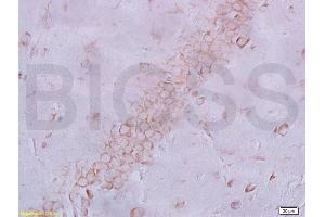 Frozen section rat brain labeled with Anti-NeuN Polyclonal Antibody, Unconjugated (ABIN732068) at 1:200 followed by conjugation to the secondary antibody and DAB staining (NeuN anticorps  (AA 51-150))