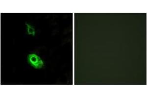 Immunofluorescence analysis of HeLa cells, using EDG3 Antibody. (S1PR3 anticorps  (AA 1-50))