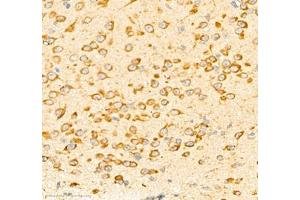 Immunohistochemistry of paraffin embedded mouse brain using PTPN12 (ABIN7075292) at dilution of 1: 1250 (400x lens)