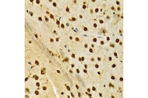 Immunohistochemistry of paraffin-embedded Rat brain using HNRNPA2B1 antibody at dilution of 1:100 (x400 lens). (HNRNPA2B1 anticorps  (AA 1-180))
