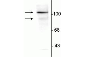 Western blot of T47D cell lysate prepared from cells that had been incubated in the presence of the synthetic progestin agonist R5020 (500 nM) showing specific immunolabeling of the ~90 kDa PR-A isoform and the ~120 kDa PR-B isoform of the progesterone receptor phosphorylated at Ser294. (Progesterone Receptor anticorps  (pSer294))