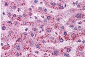 Human Liver: Formalin-Fixed, Paraffin-Embedded (FFPE) (Cyclin D1 anticorps)