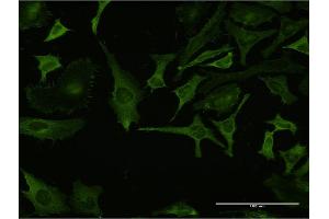 Immunofluorescence of monoclonal antibody to RPL32 on HeLa cell. (RPL32 anticorps  (AA 33-132))