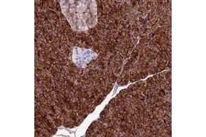 Immunohistochemical staining of human pancreas with ANO6 polyclonal antibody  shows strong cytoplasmic and membranous positivity in exocrine glandular cells at 1:500-1:1000 dilution. (Anoctamin 6 anticorps)
