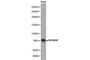Western Blotting (WB) image for anti-Ribosomal Protein S6 Kinase, 70kDa, Polypeptide 1 (RPS6KB1) antibody (ABIN1874663) (RPS6KB1 anticorps)