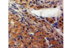 Used in DAB staining on fromalin fixed paraffin-embedded Ovary tissue