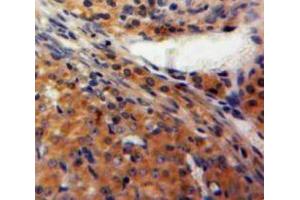 Used in DAB staining on fromalin fixed paraffin-embedded Ovary tissue (FBLN2 anticorps  (AA 858-1069))