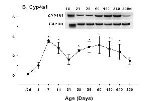 Age-related expression of CYP-4 family gene/proteins in livers of male rats. (CYP4A11 anticorps  (AA 351-450))