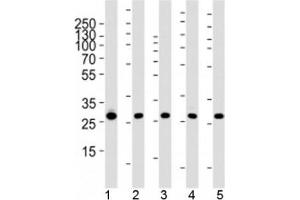 Western blot analysis of lysate from 1) 293, 2) MCF-7, 3) HepG2, 4) mouse NIH3T3 cell line and 5) rat liver tissue using PHB1 antibody at 1:1000.
