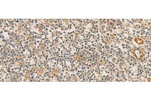 Immunohistochemistry of paraffin-embedded Human tonsil tissue using RAB13 Polyclonal Antibody at dilution of 1:50(x200)