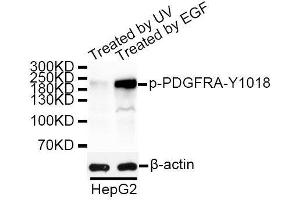 Western blot analysis of extracts of HepG2 cells, using Phospho-PDGFRA-Y1018 antibody. (PDGFRA anticorps  (pTyr1018))