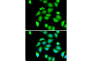 Immunofluorescence analysis of U20S cell using RPS5 antibody. (RPS5 anticorps)