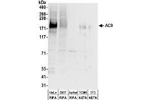 Western Blotting (WB) image for anti-Adenylate Cyclase 9 (ADCY9) (AA 1303-1353) antibody (ABIN7455037)