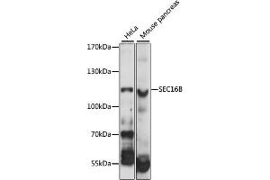 Western blot analysis of extracts of various cell lines, using SEC16B antibody (ABIN6292556) at 1:1000 dilution. (SEC16B anticorps)